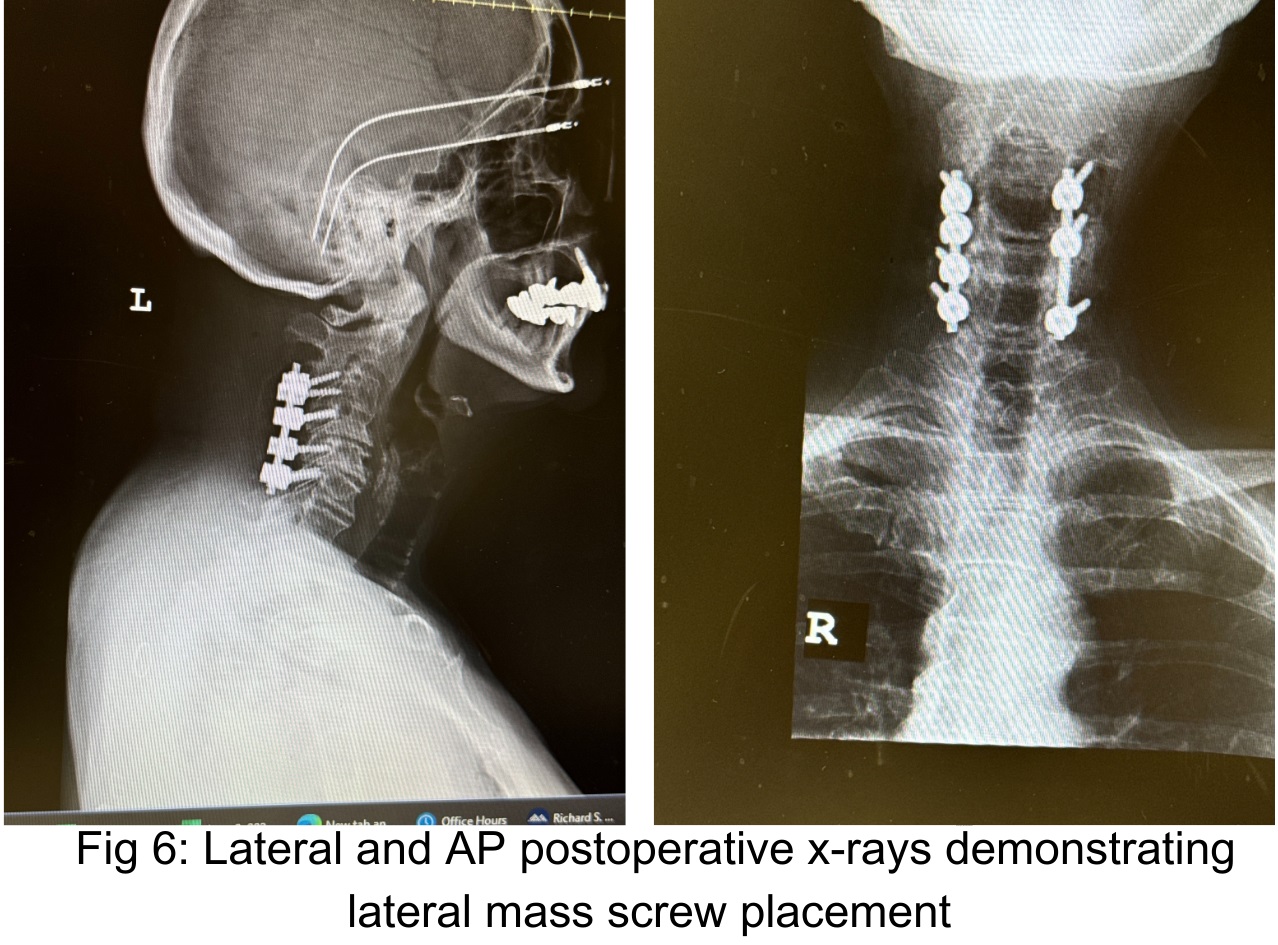 NSPC Brain & Spine Surgery (7)